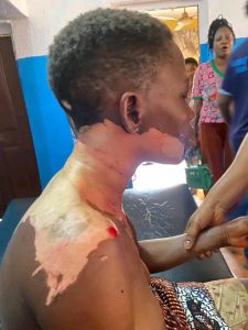 Man Bathes Wife With Hot Oil In Ogun State